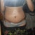 7 days post op!