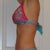 side view. 3 months post op