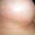 Right breast