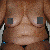 Pre-op