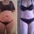 Before and 6 days post op - side by side!