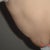 2days before surgery, leaning forward (side view)