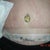 Once that thing falls off I will have a new belly button!!
