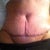 PODay 4 - close up of tummy scar and belly button