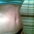 three and one half months-scar is fading!!! :)