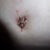 Belly Button. Seems less attractive with close up :)