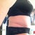 4 weeks PO Right side