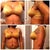 The pictures on top are from New Years and the bottom I are from today Jan 10... They have started to drop and swelling has went down a lot. On the bottom pics you can see my straps are pulled tighter and they are not so high on the second pic.. Making progress.. ;)