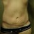 3 Weeks PO