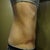 3 Weeks PO right side