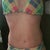 Another bikini at 3 Weeks PO
