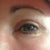 Left eye...doing great!