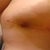 Reached for something to fast and had a sharp pain in my upper breast that went away after a while.  Had this bruise the next morning.  PS said to apply heat and watch for any changes.  It's getting smaller already.