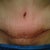 3 weeks post op looking better and better every day