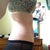 9 days post op