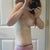 Day 5 Post Op.  Looking flat!