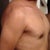 After 2 wks