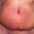 4 weeks PO today.  This is a pic of incision.