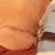 4 day post op, closer look of my drain