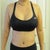 10 Days Post-Op