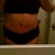 3 weeks post op