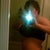 13 weeks post op
