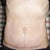 After 8 wks