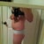 before surgery, left side again but different angle