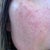 17 days after.