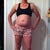 This is what I look like 3 weeks pre-op