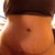 3months scar
