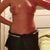 mid week 2 post op, top of stomach/rib cage swelled up a bit