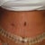incision across bikini line