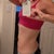 Before, side, already pretty "flat", and love my shape, just want the skin gone