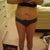 3 1/2 weeks pre-op, front view