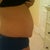 3 1/2 weeks pre-op, right side view