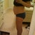 3 1/2 weeks pre-op, right side view