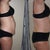 Post Op - Day 6
Before and After