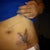 A day after first session. It's pretty much a burn. The session itself hurt but not afterwards like some people say.