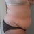 Before - Side 1 - 5/8/12
