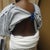DAY OF SURGERY - Back Rolls