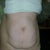 Before, front, yuck!!