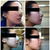 Top row: Day 2, Day 4; 
Bottom row: Day 7, Day 10