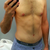 Post Op - 3 months