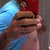 Post Op - Day 5 - Side view is starting to flatten out which is nice.
