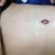 New belly button