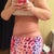 6 weeks post op