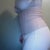 fajate with SQUEEM on top post op day 13 1/23/13