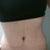 11 weeks post op
