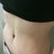 11 weeks post op.